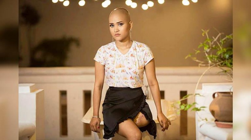 Una imagen de la joven que lucha contra el cáncer de huesos y que desfilará en el Bionic Fashion Day. FOTO: Instagram