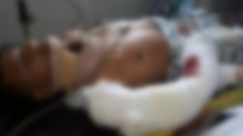 Un efectivo de UMOPAR se recupera en el hospital de Villa Tunari. Foto: Vía Twitter Jhon Arandia
