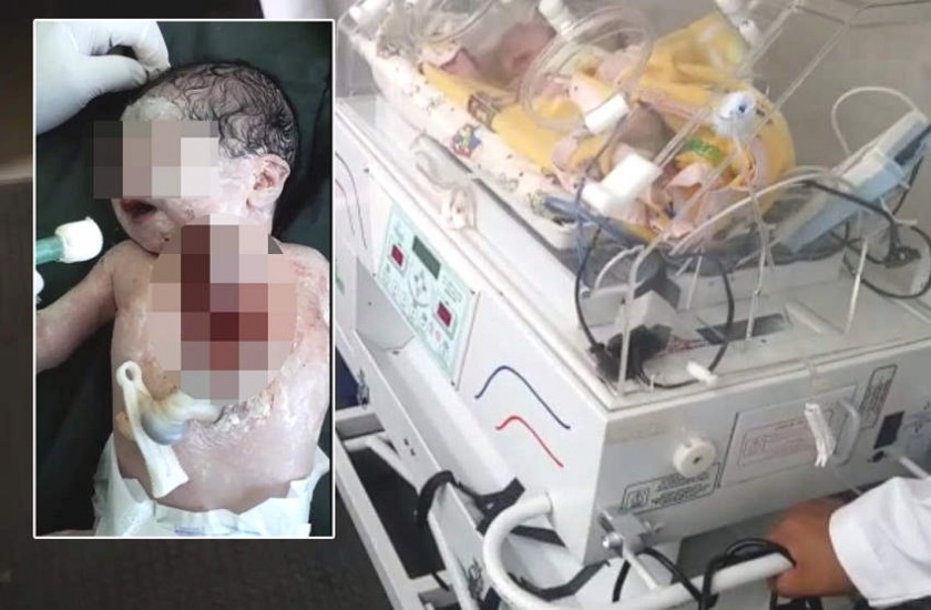 La niña fue trasladada en Sucre y está internada en el Hospital de la Mujer. Fotos: Capturas de video