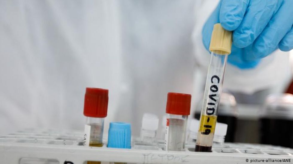 El covid-19 es una virus que azota al planeta.