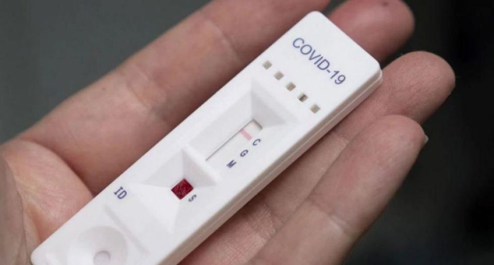Algunas pruebas rápidas de coronavirus ya cuentan con permisos para ser usadas a nivel nacional.