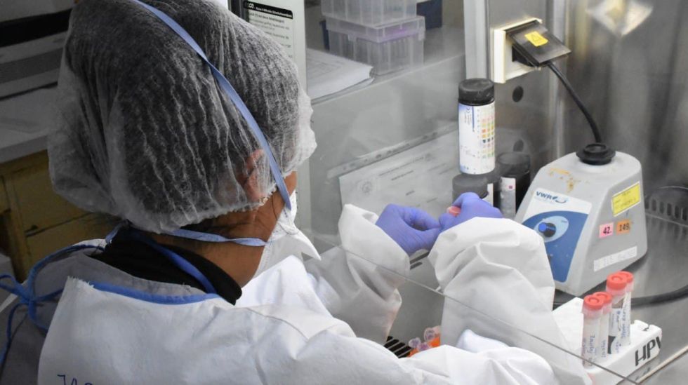 Una trabajadora de salud manipula una muestra para el test de viruela del mono.