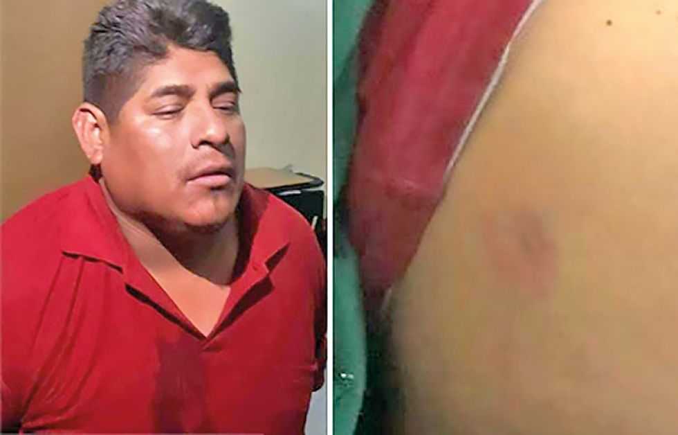 APREHENDIDO. El dirigente y las contusiones que, según afirmó, le causaron los policías.