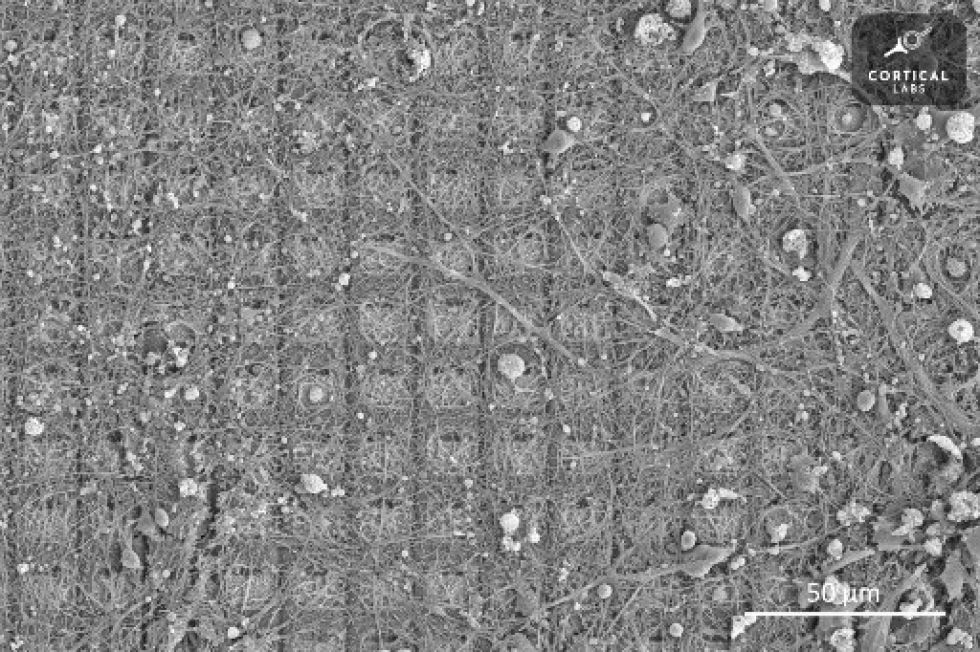 Una iimagen de microscopio electrónico de barrido de un cultivo neuronal que ha estado creciendo durante más de seis meses en una matriz de electrodos múltiples de alta densidad.
