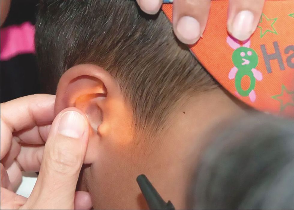 cuidados. Cualquier objeto en el oído, la nariz o la boca del niño podría ser perjudicial para su salud.