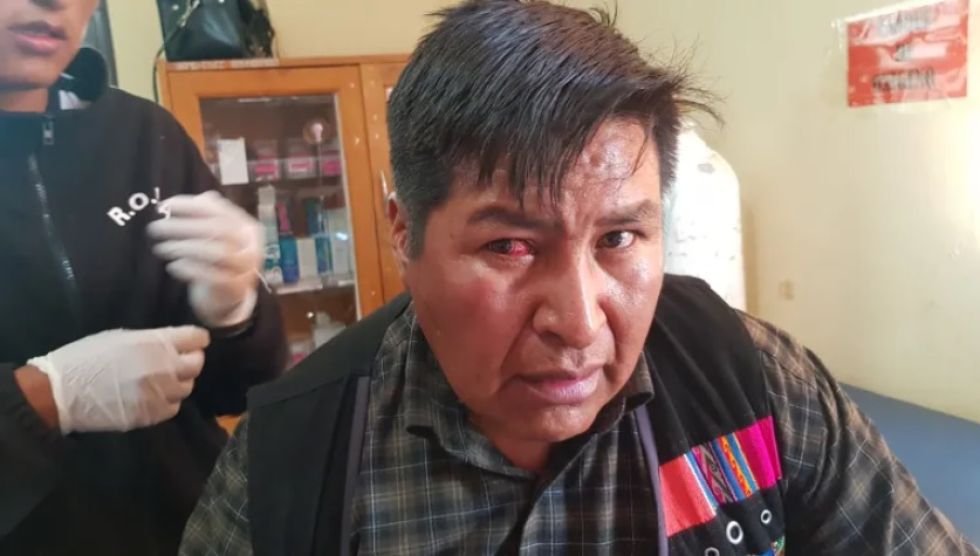 Martín Choque denunció que sufrió agresiones, así como también su esposa.  