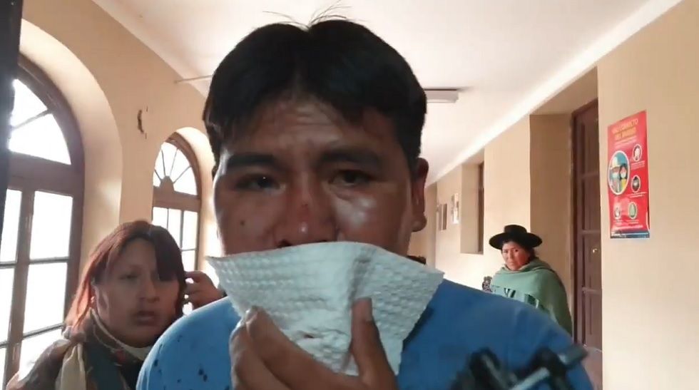 El diputado potosino Abelardo Colque luego de ser agredido por un grupo violento.