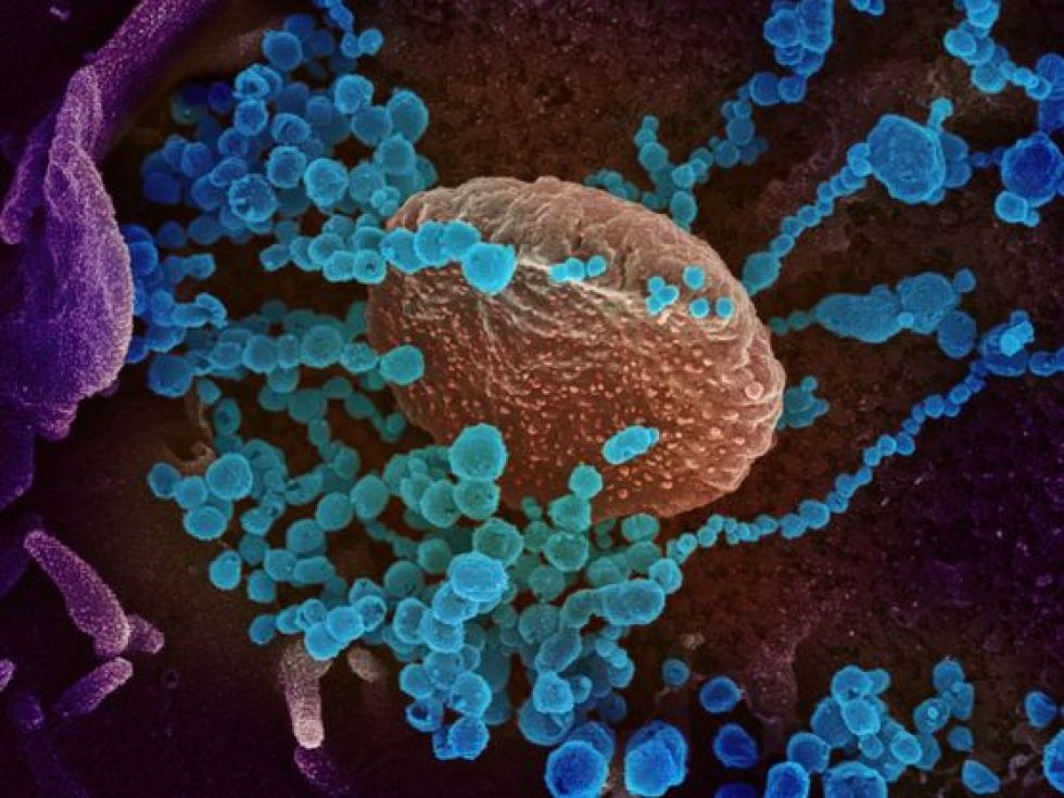 Una imagen de microscopio electrónico que muestra al SARS-CoV-2, el virus que causa el covid-19.