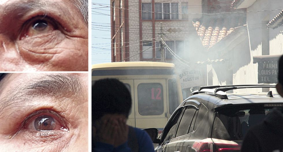 CONTAMINACIÓN. Vecinos muestran sus problemas de salud en los ojos a causa del smog.