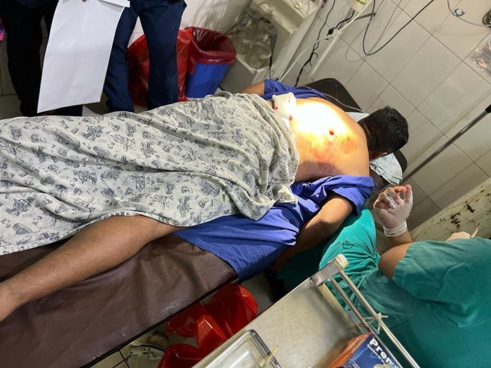 Un sargento mayor de la Policía resultó herido por una turba en el Chapare.
