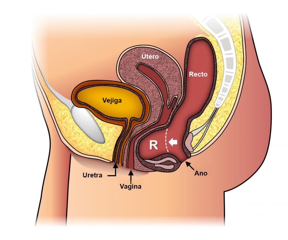 En el suelo pélvico de la mujer el ano está cerca de la vagina y la uretra que hace más susceptible la aparición de infecciones urinarias recurrentes por contaminación