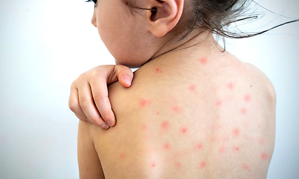 VIRUS. Advierten sobre el grado de contagio.
